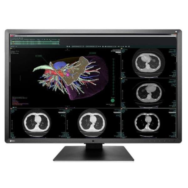 EIZO RadiForce RX660 - Monitor a LED - …